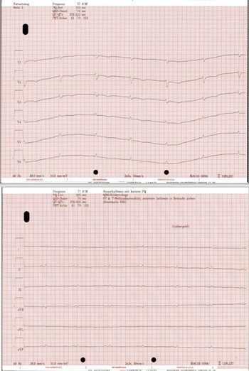 Figure 0