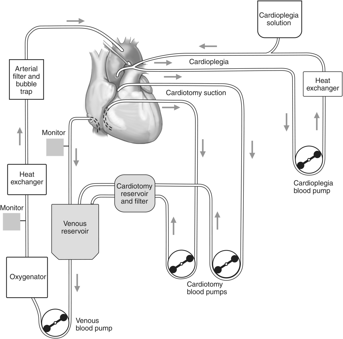 Cardiopulmonary Bypass Diagram