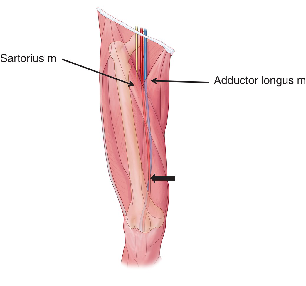 superficial femoral vein