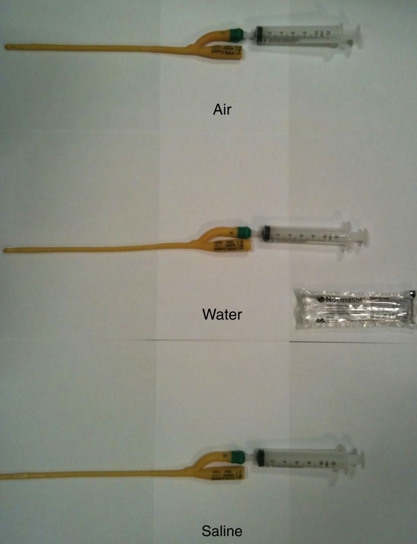 Inflation of Foley catheters for postnasal packing The Journal of