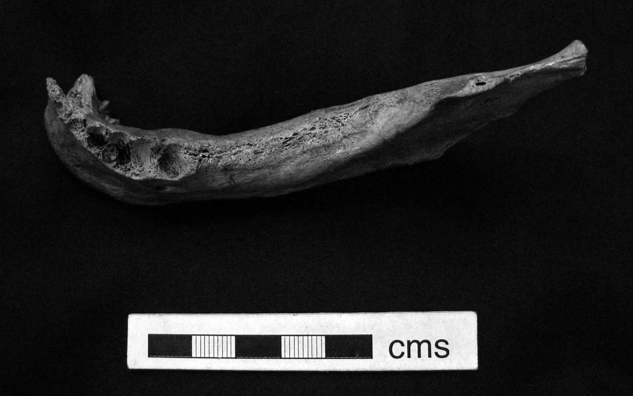 Tilbury Man': A Mesolithic Skeleton from the Lower Thames | Proceedings of  the Prehistoric Society | Cambridge Core, image size:1283x803