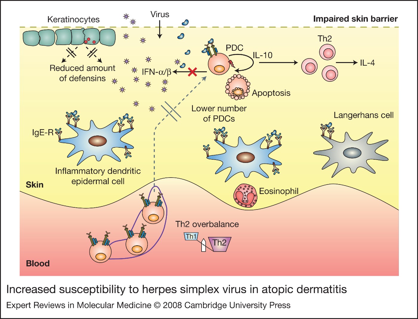 Molecular pathogenesis and clinical implications of eczema herpeticum