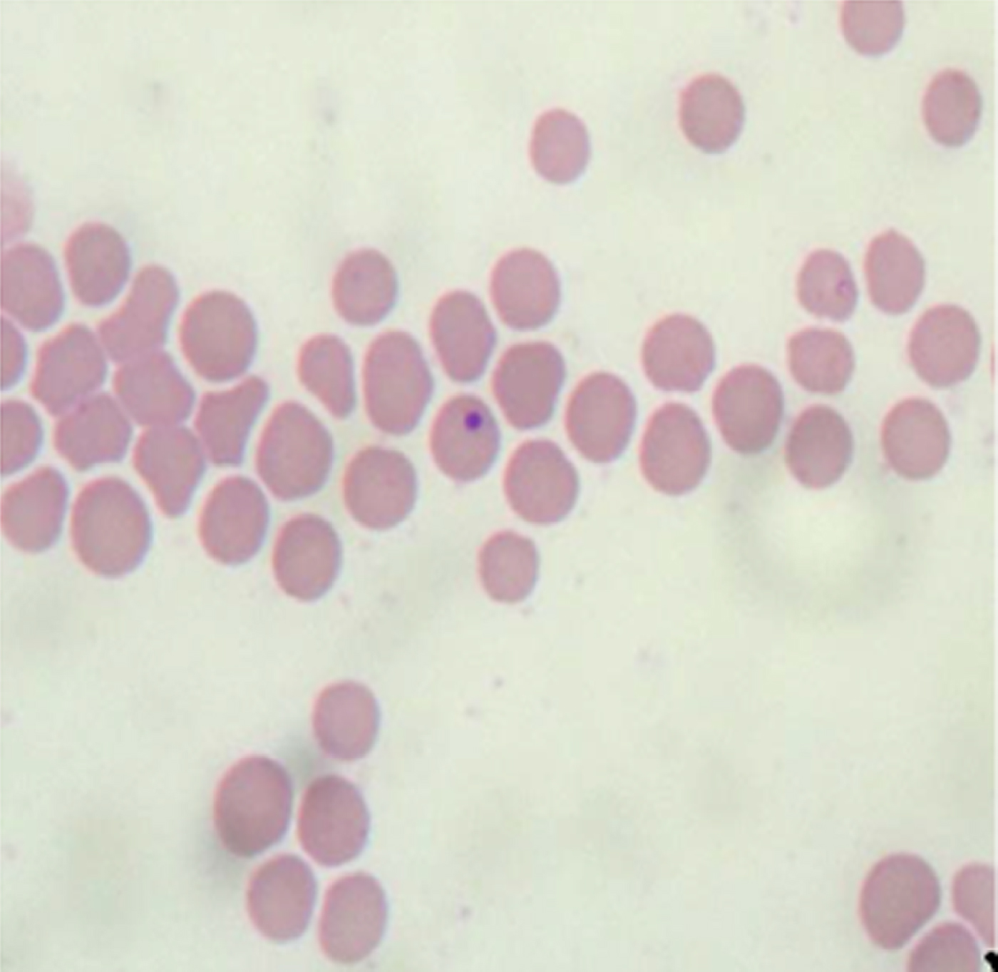 Alpha proteobacteria of genus Anaplasma (Rickettsiales: Anaplasmataceae ...