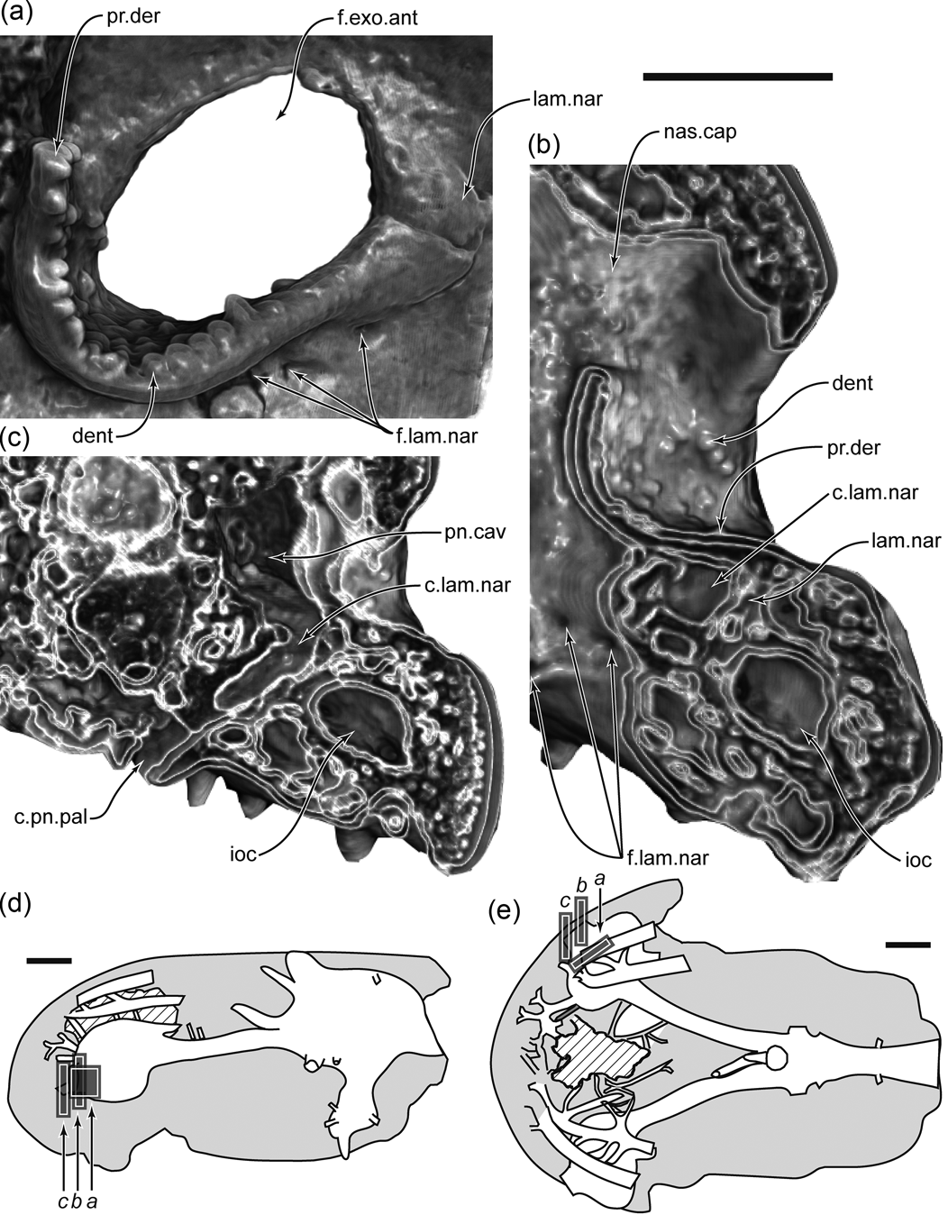 The endocranial anatomy of Gogonasus andrewsae Long, 1985 revealed 