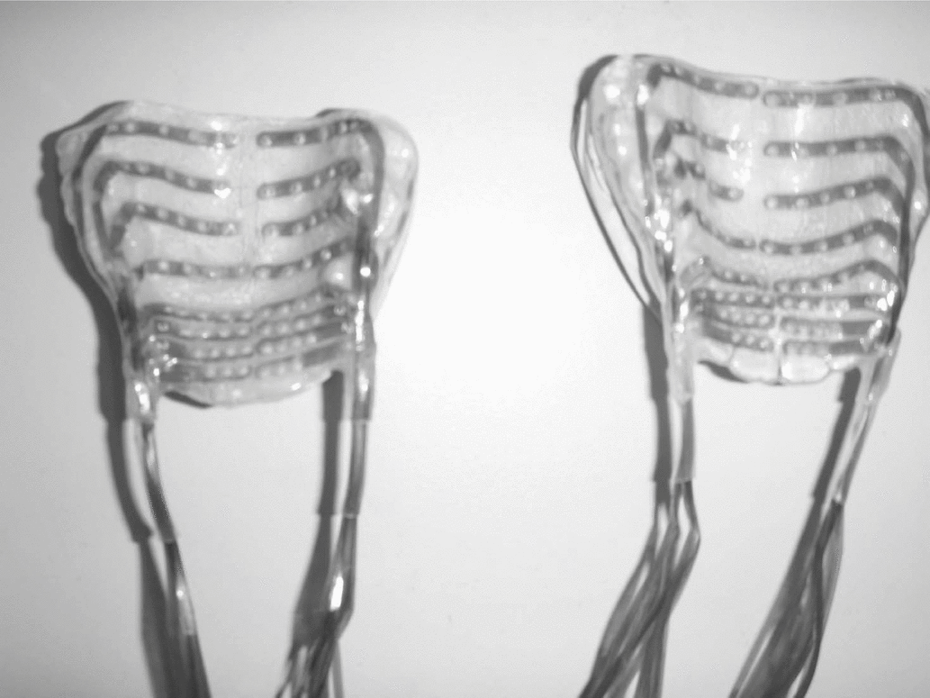 Electropalatography data from Central Arrernte A comparison of the new Articulate palate with