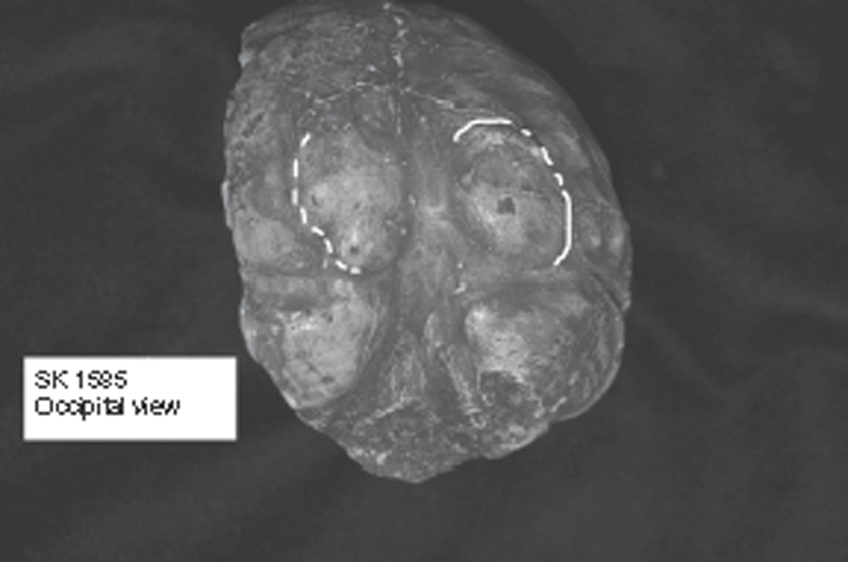 The issue of brain reorganisation in Australopithecus and early