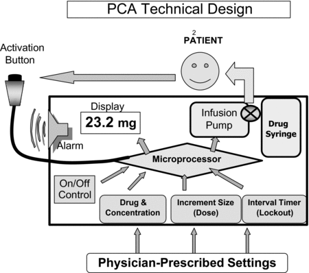 Patient-Controlled Analgesia Pumps
