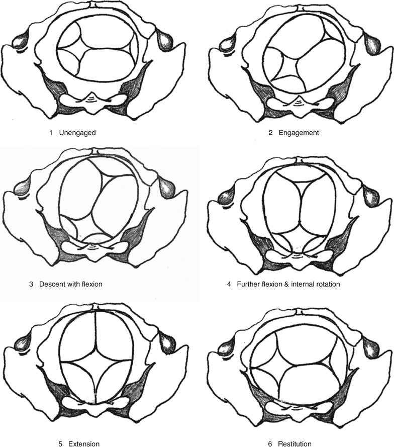 Pelvic And Fetal Cranial Anatomy And Mechanism Of Labour, 41% OFF