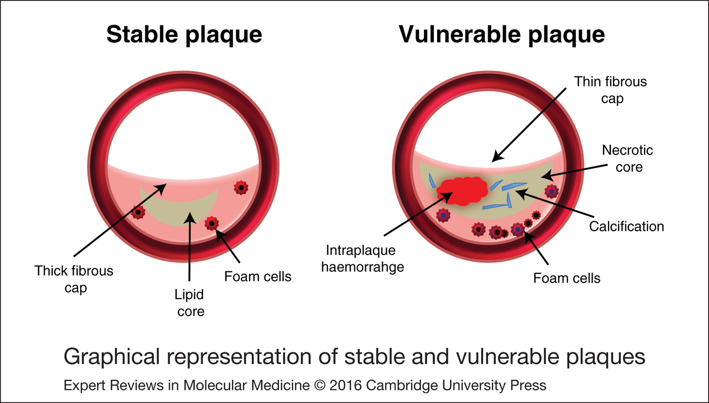 preclinical-models-of-atherosclerosis-the-future-of-hybrid-pet-mr