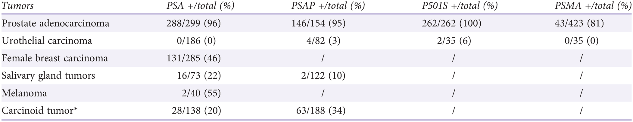 Adenocarcinoma de próstata de Gleason 10 13 13a 360t 516 512