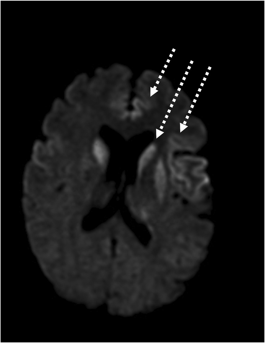 Neuroimaging in dementia (Chapter 3) - The Behavioral