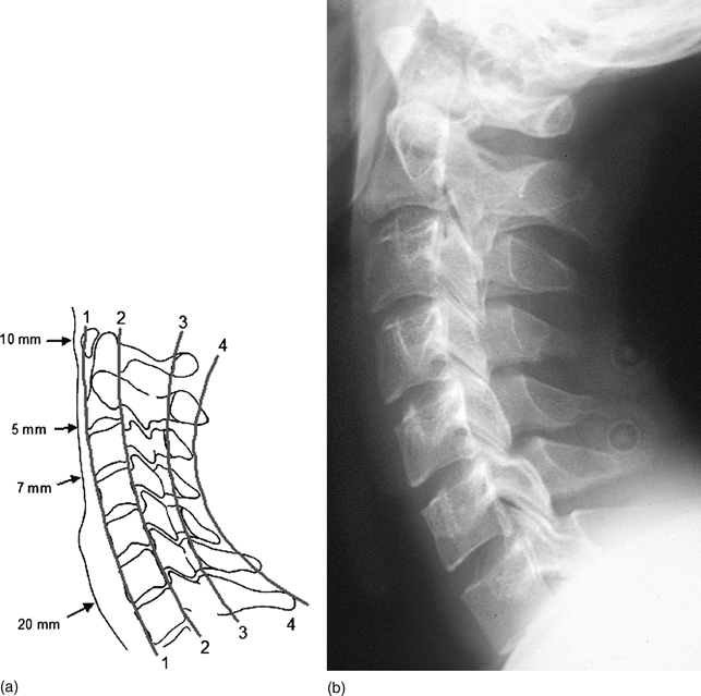 Imaging in trauma (Section 4) - Trauma Imaging in trauma (Section 4) - Trauma