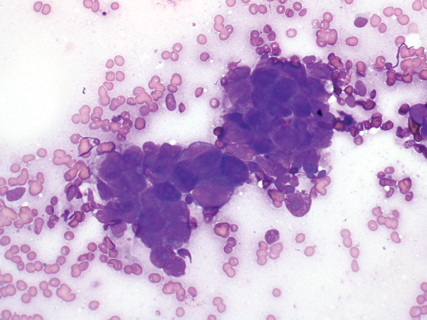 The Testis Paratesticular Structures And Male External Genitalia Chapter 34 Silverberg S Principles And Practice Of Surgical Pathology And Cytopathology