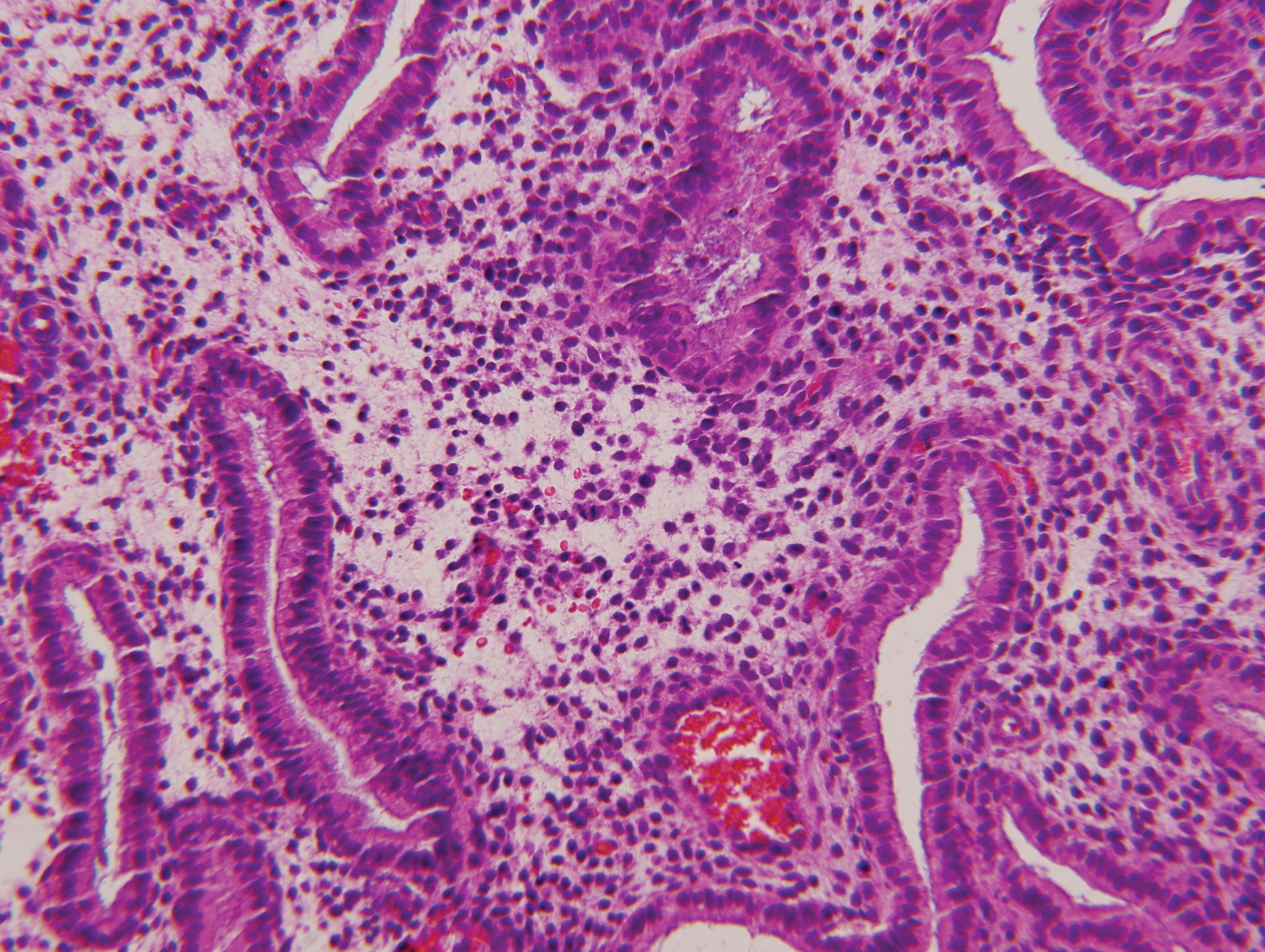Histology secretory endometrium Histological patterns