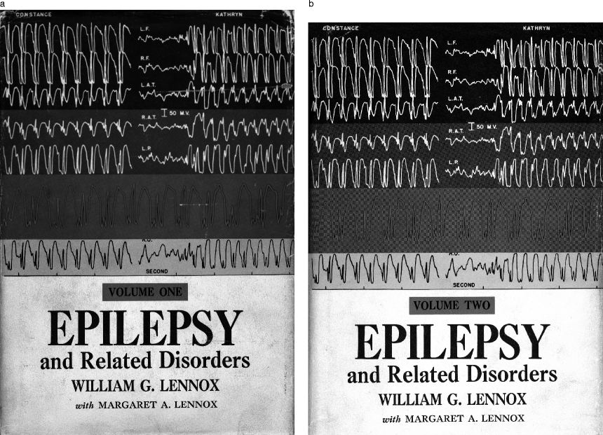 Historical introduction: the causes of epilepsy in the pre 