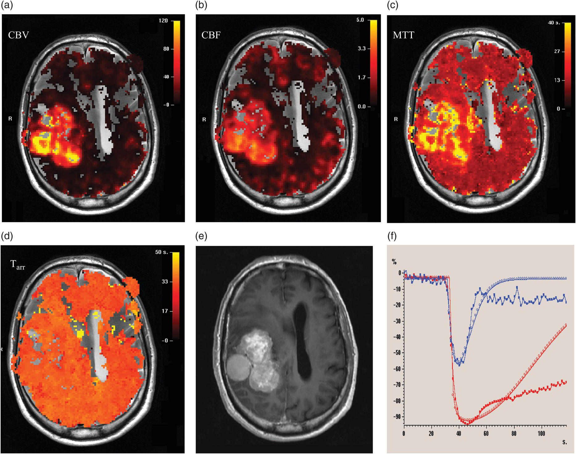 To BOLDly Go: fMRI, Perfusion and Diffusion (Chapter 18) - MRI