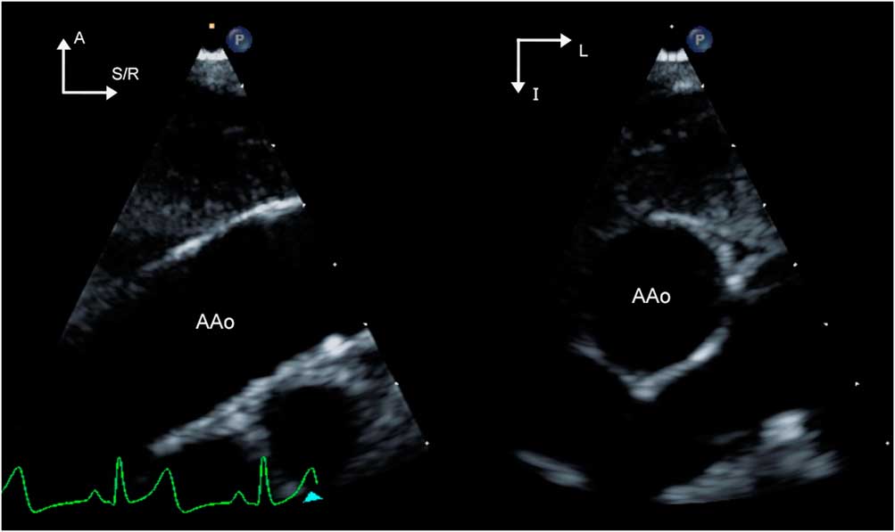 Assessment of the structure and function of the aorta by ...