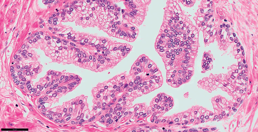 prostate gland histology)