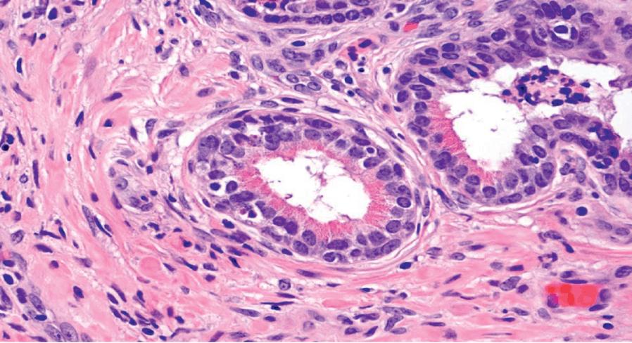 prostate central zone histology