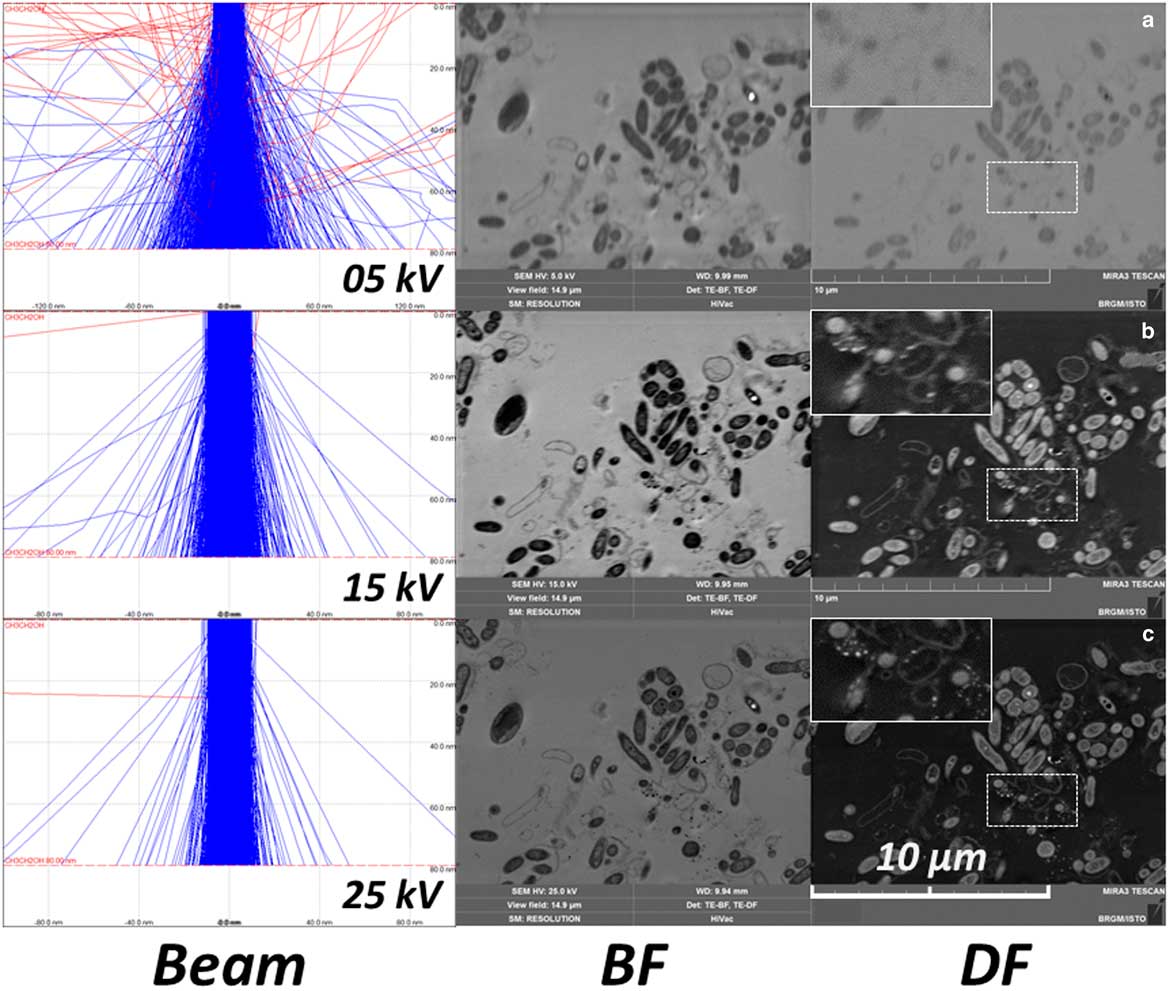 Cryo-Scanning Electron Microscopy (SEM) And Scanning Transmission ...