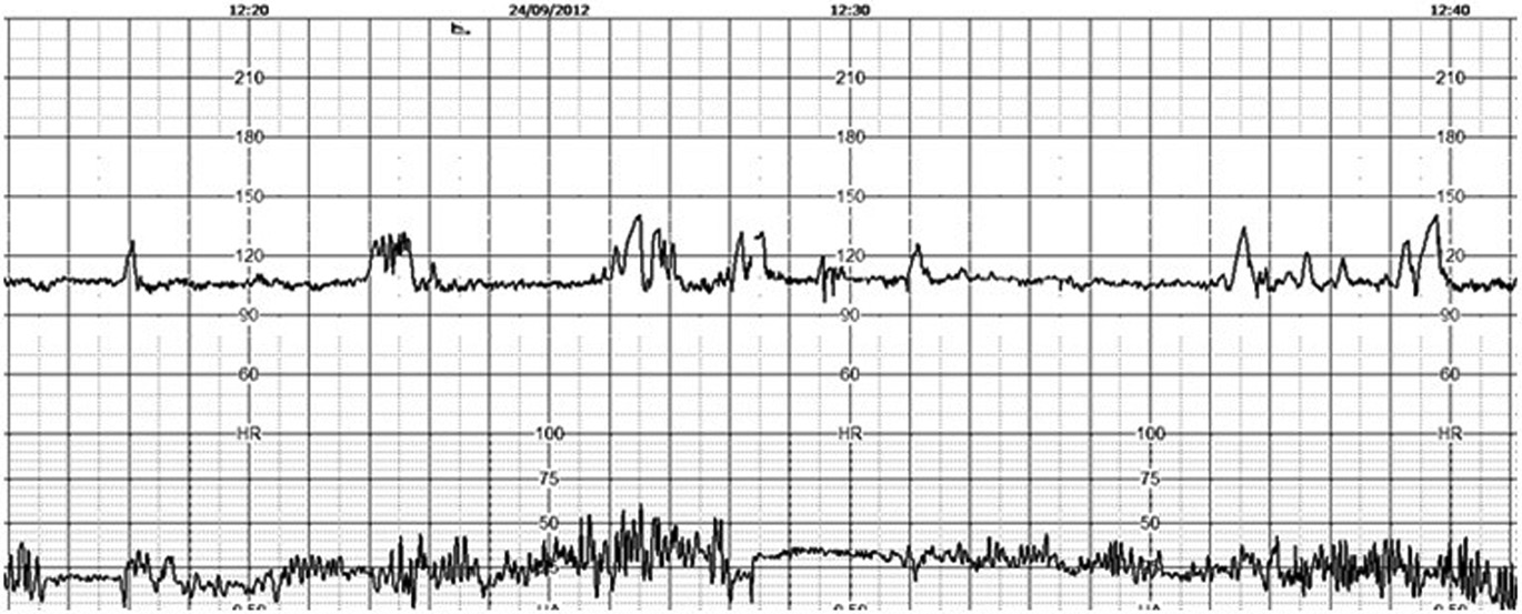 Answers To Exercises Handbook Of Ctg Interpretation
