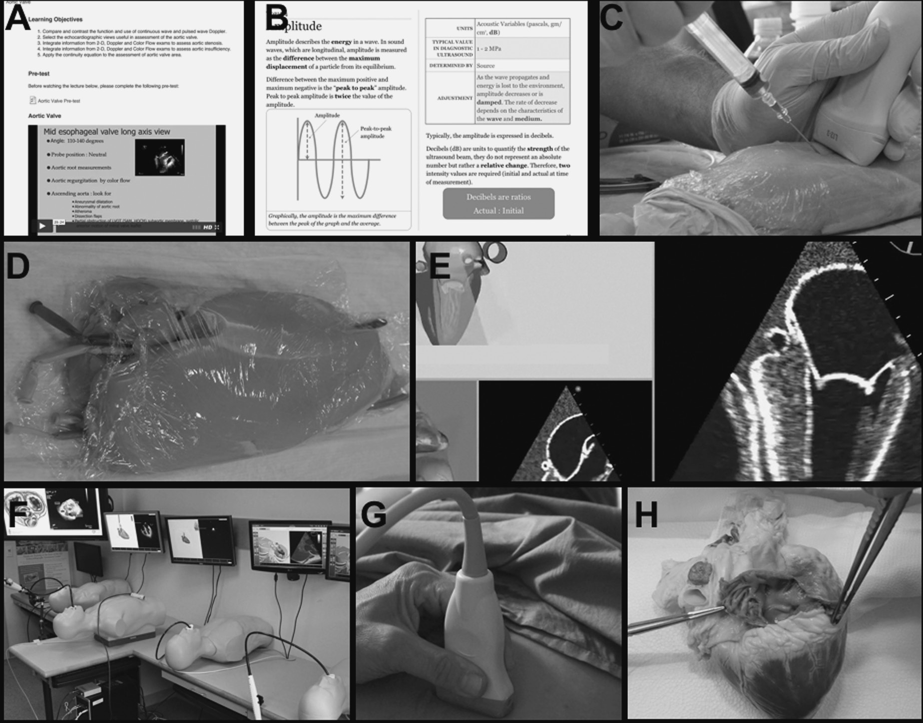PERIOPERATIVE TEE SelfAssessment&Review｜本・雑誌・漫画