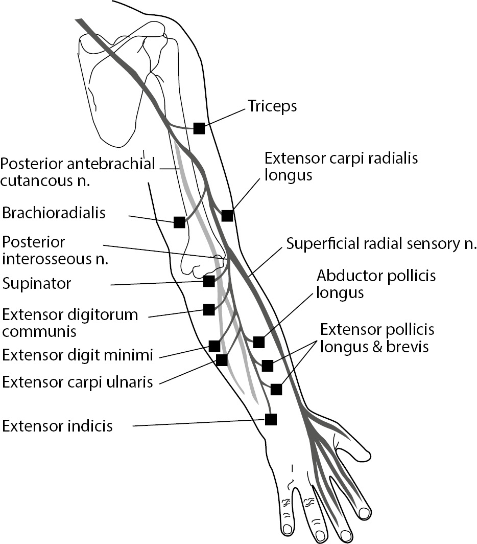 Posterior Interosseous Nerve