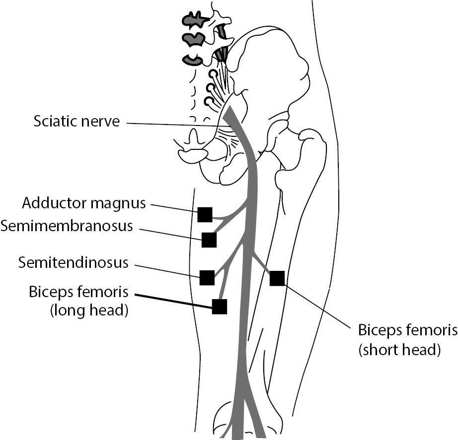 sciatic nerve distribution