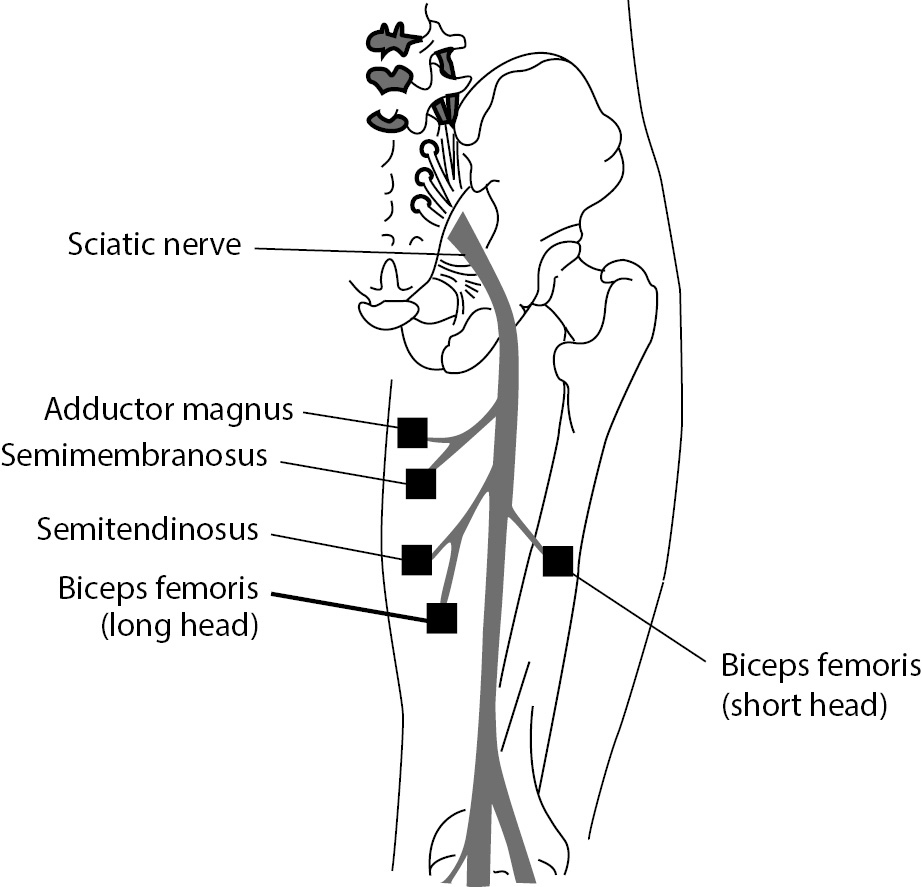 sciatic nerve muscle innervation