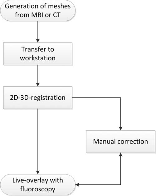 A New Approach Of Three Dimensional Guidance In Paediatric Cath Lab Segmented And Tessellated Heart Models For Cardiovascular Interventions In Chd Cardiology In The Young Cambridge Core