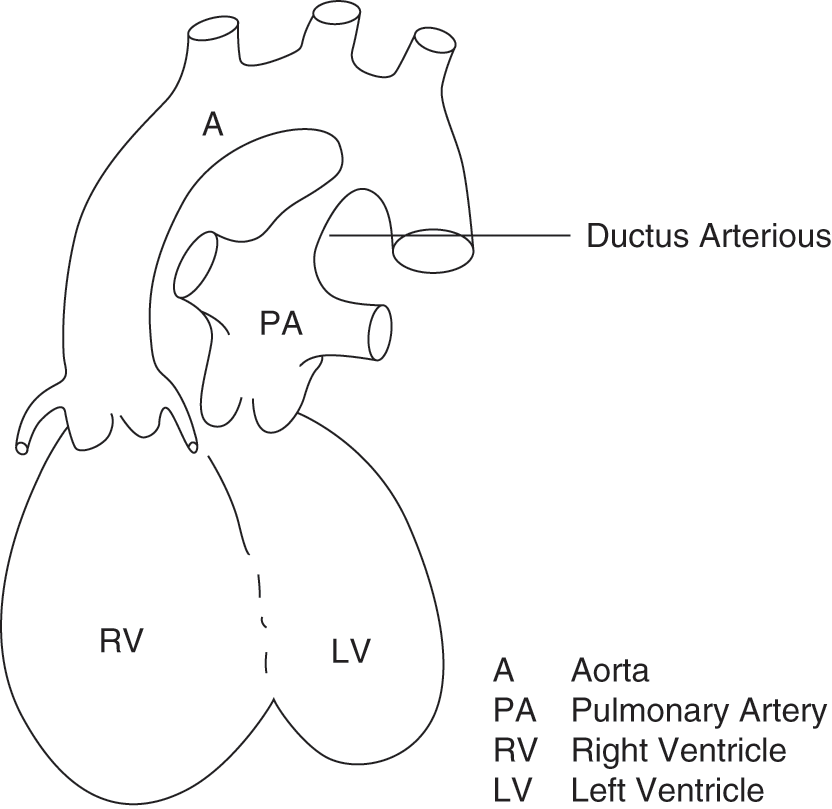 Frontiers  Right and Left Ventricular Strain Patterns After the Atrial  Switch Operation for D-Transposition of the Great Arteries—A Magnetic  Resonance Feature Tracking Study