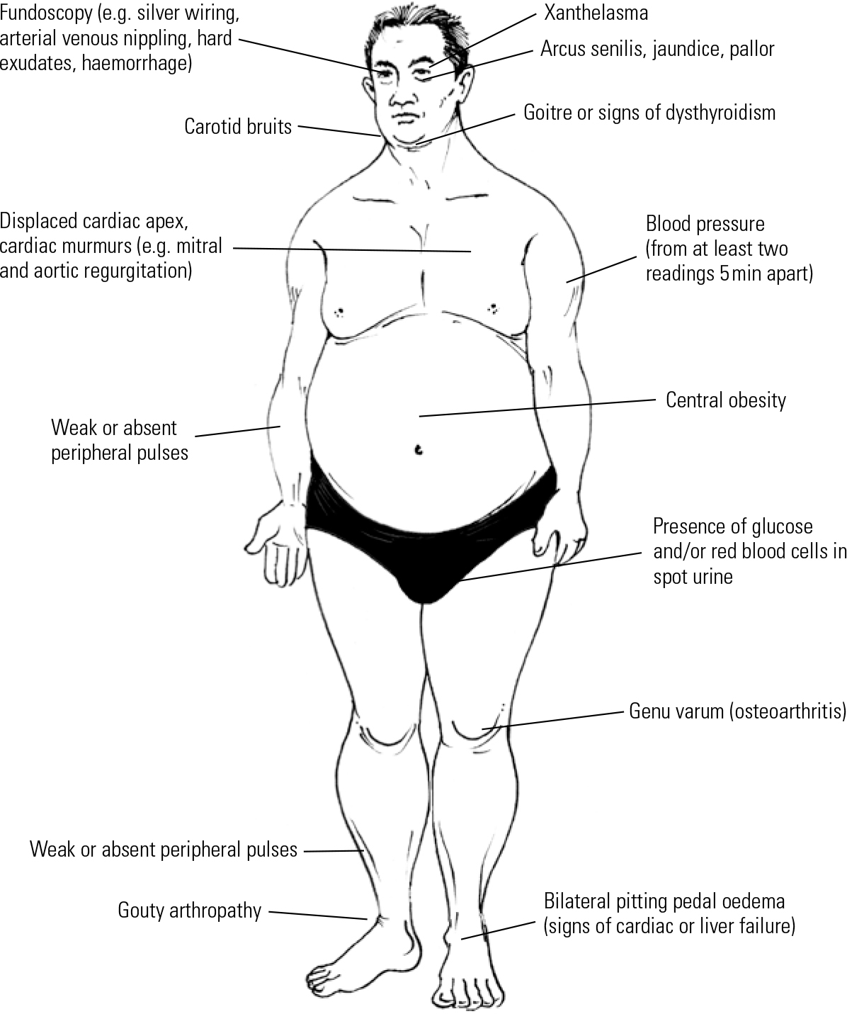 Metabolic Syndrome In Psychiatry Advances In Understanding And Management Advances In 0392