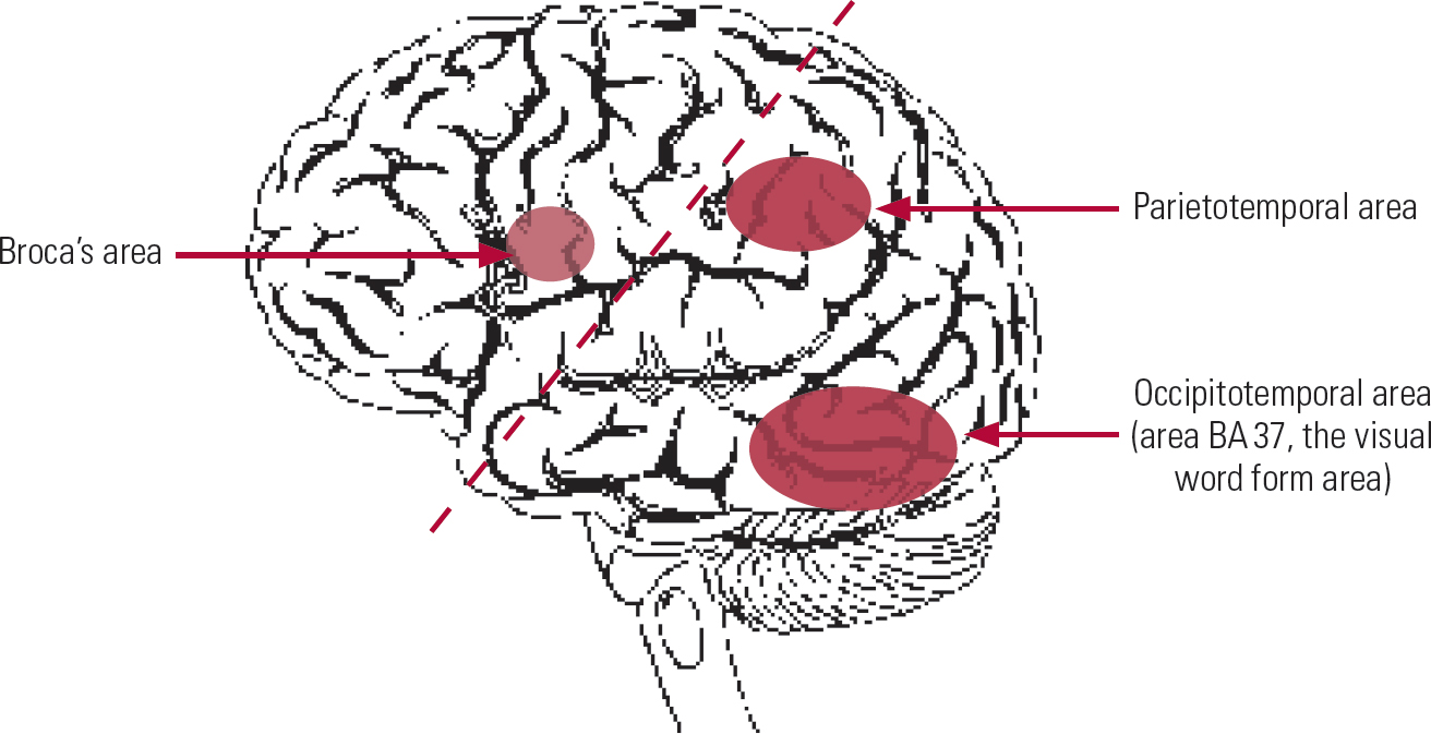 Developmental Dyslexia: An Overview | Advances In Psychiatric Treatment ...