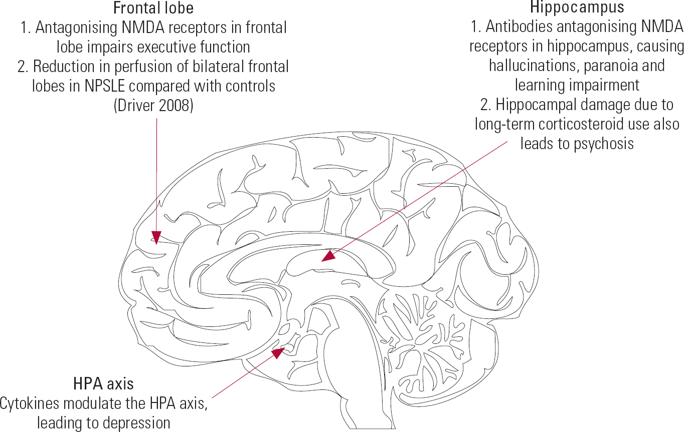 Clinical Implications Of Neuropsychiatric Systemic Lupus Erythematosus Advances In Psychiatric 7045