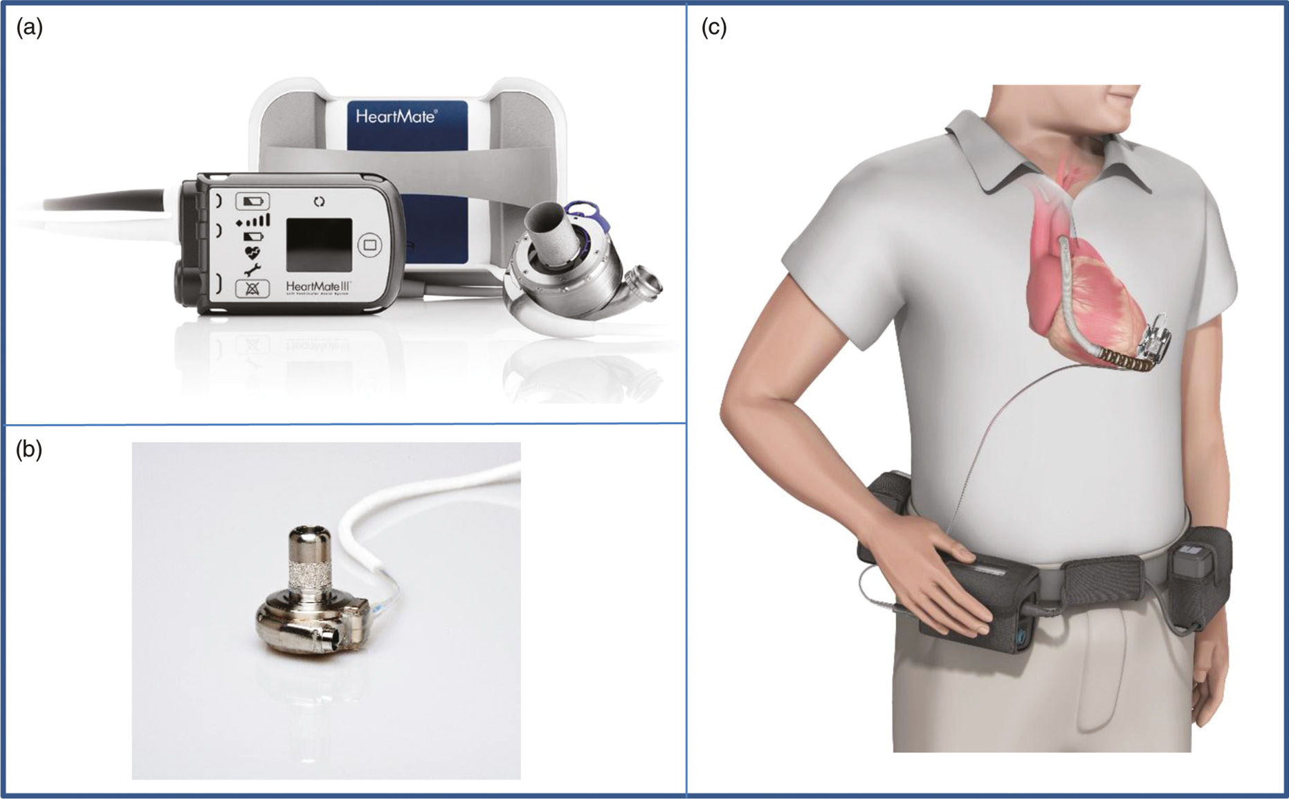 LVAD Back Pack heartmate and Heartware 