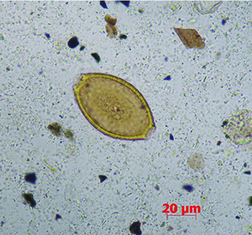 Trichuris trichiura in the mummified remains of southern Siberian nomads, Antiquity