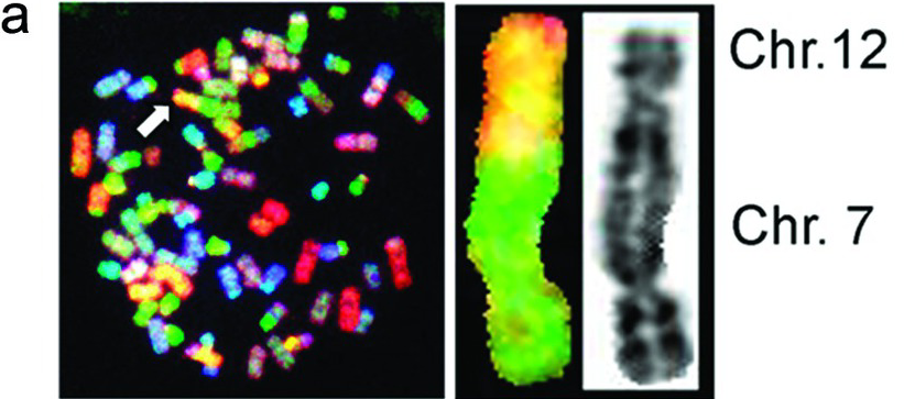 fluorescence in situ hybridization down syndrome