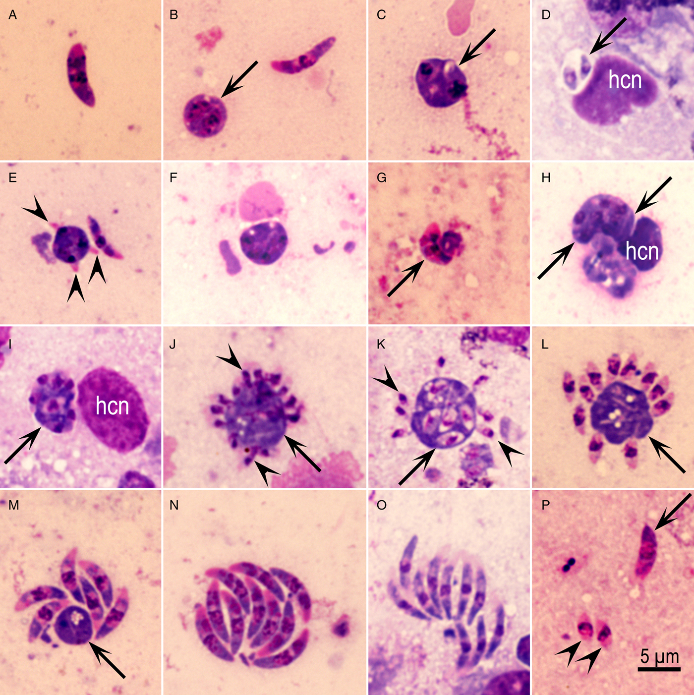 Reevaluation of the life cycle of Eimeria maxima Tyzzer, 1929 in