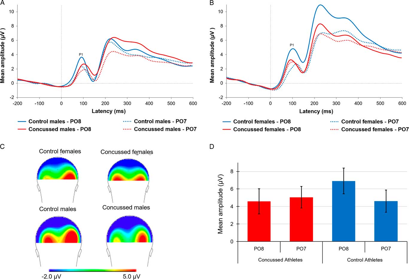 Effects Of Repeated Concussions And Sex On Early Processing Of Emotional Facial Expressions As