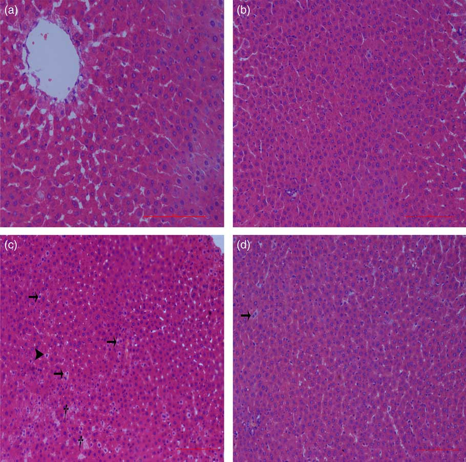 Dietary curcumin supplementation attenuates inflammation, hepatic ...