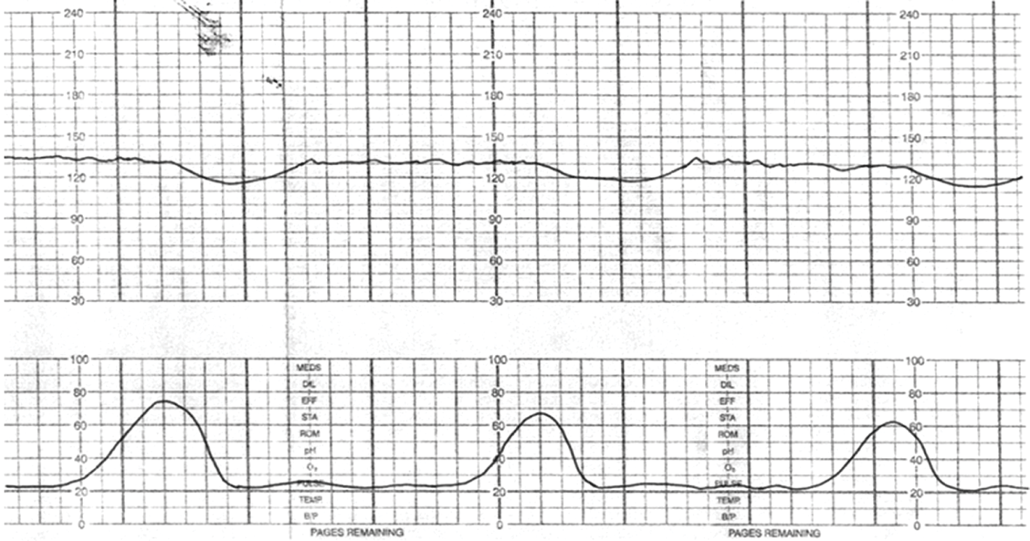 Fetal Monitoring Jeopardy Template fetal-monitoring-jeopardy-template