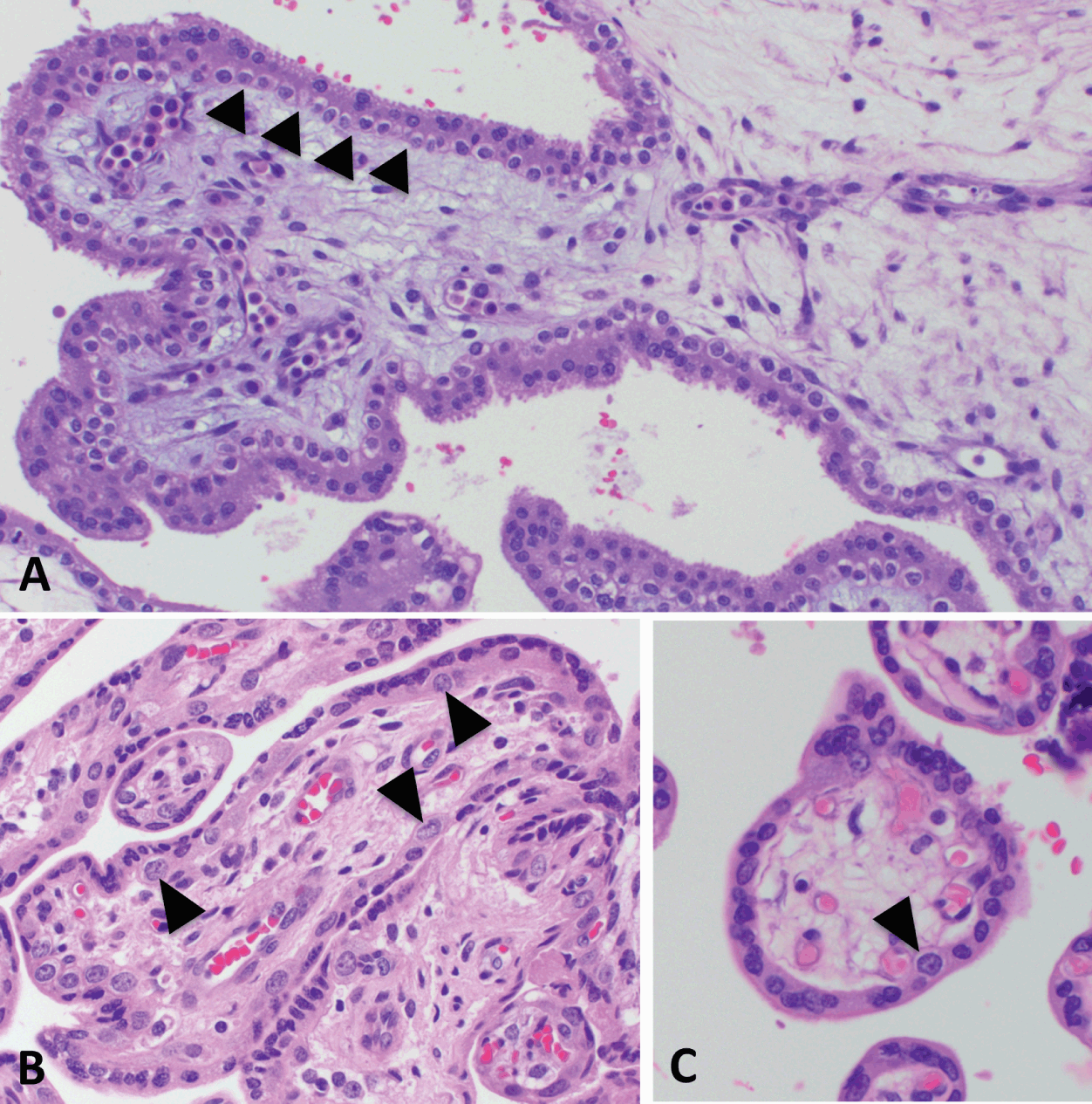 chorionic villi histology