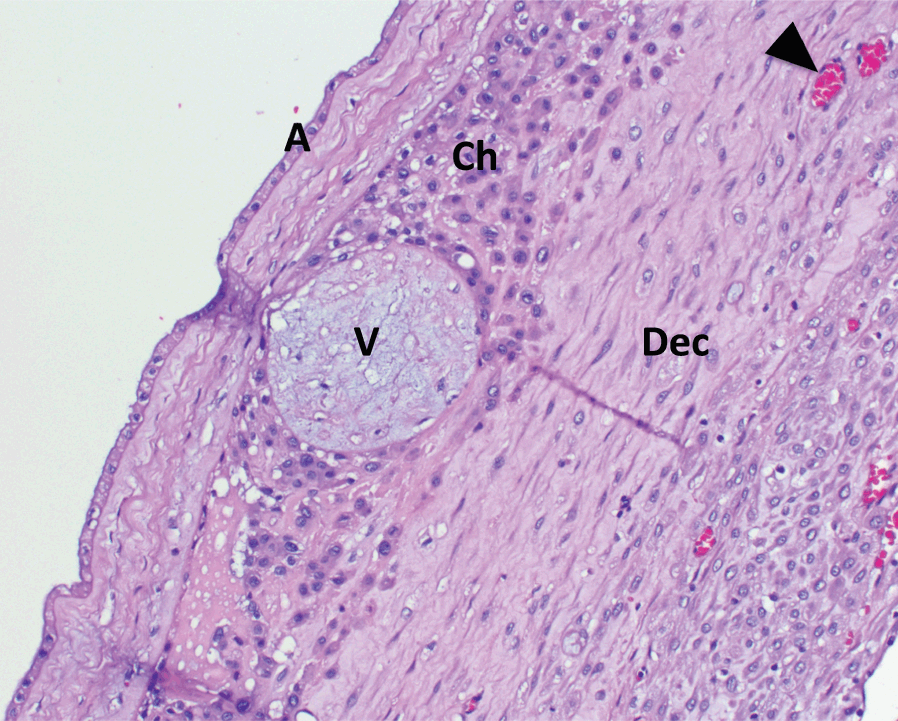 chorionic villi histology