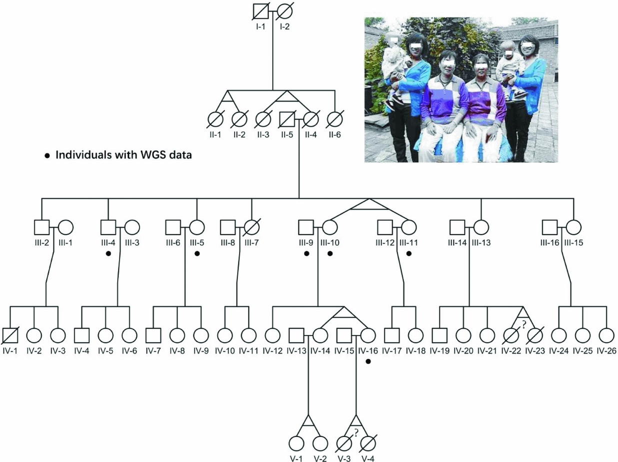 Four Generation Pedigree Of Monozygotic Female Twins Reveals Genetic