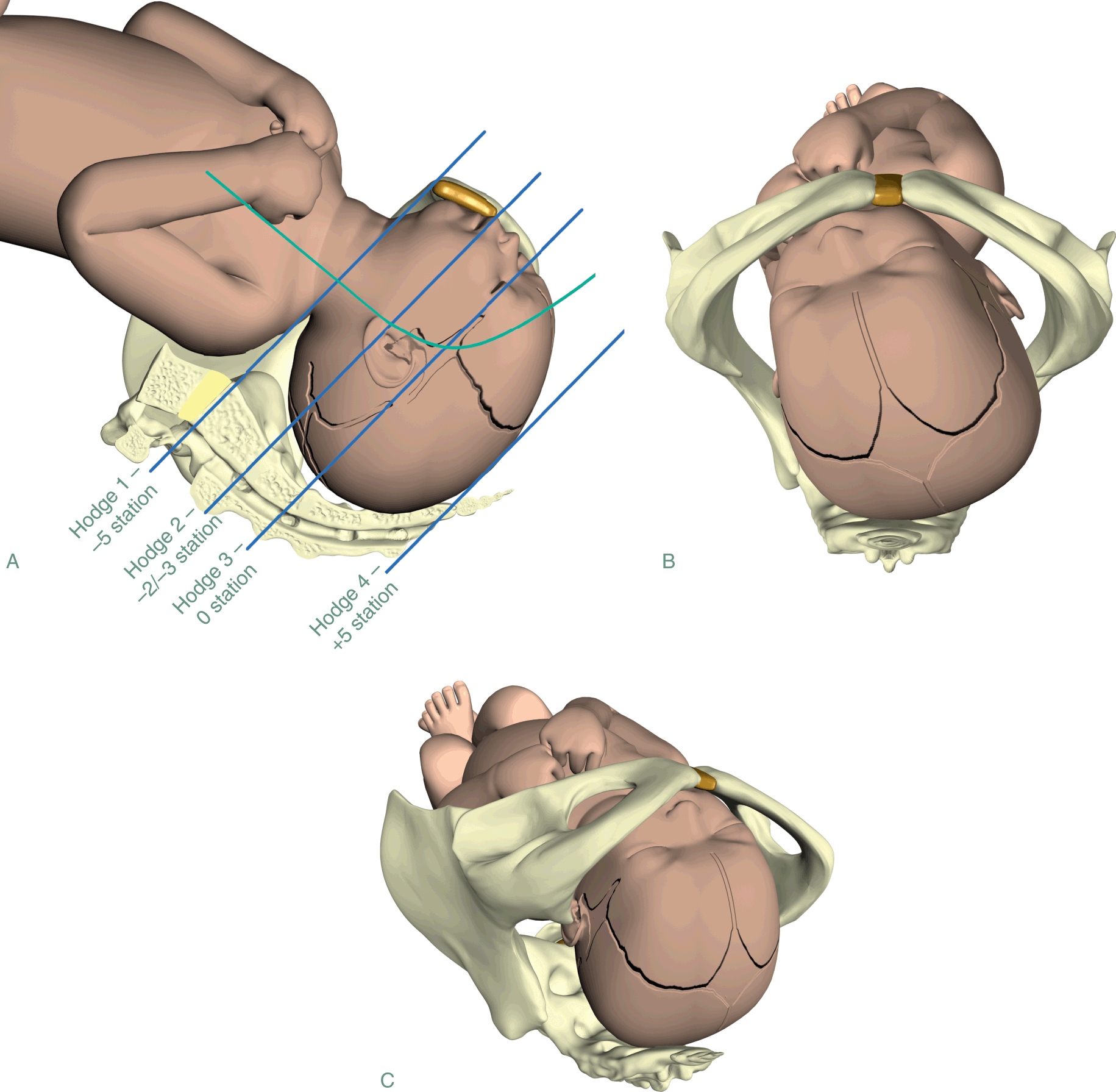 Normal Labor And Delivery Section 2 Obstetric Interventions