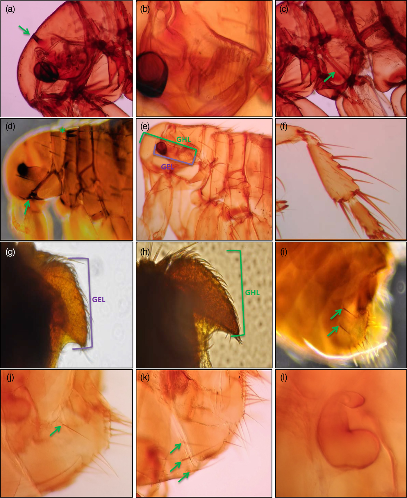 Morphological, biometrical and molecular characterization of