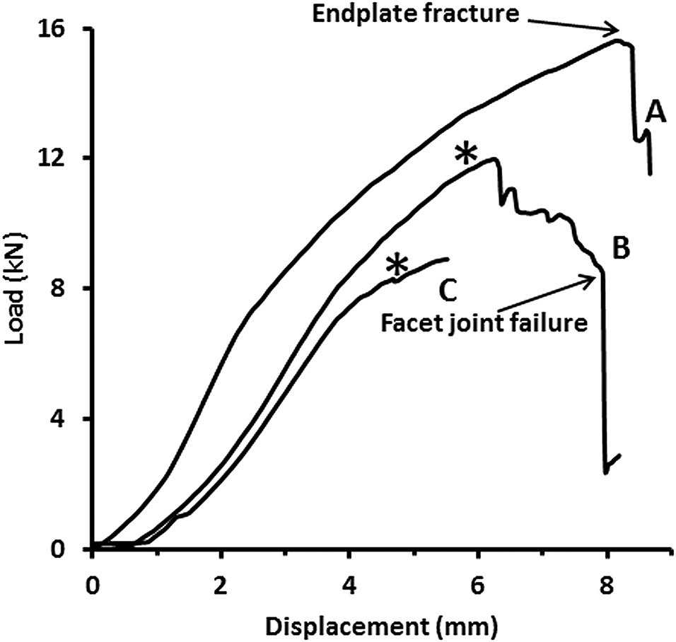 Micromechanics of fracture and damage