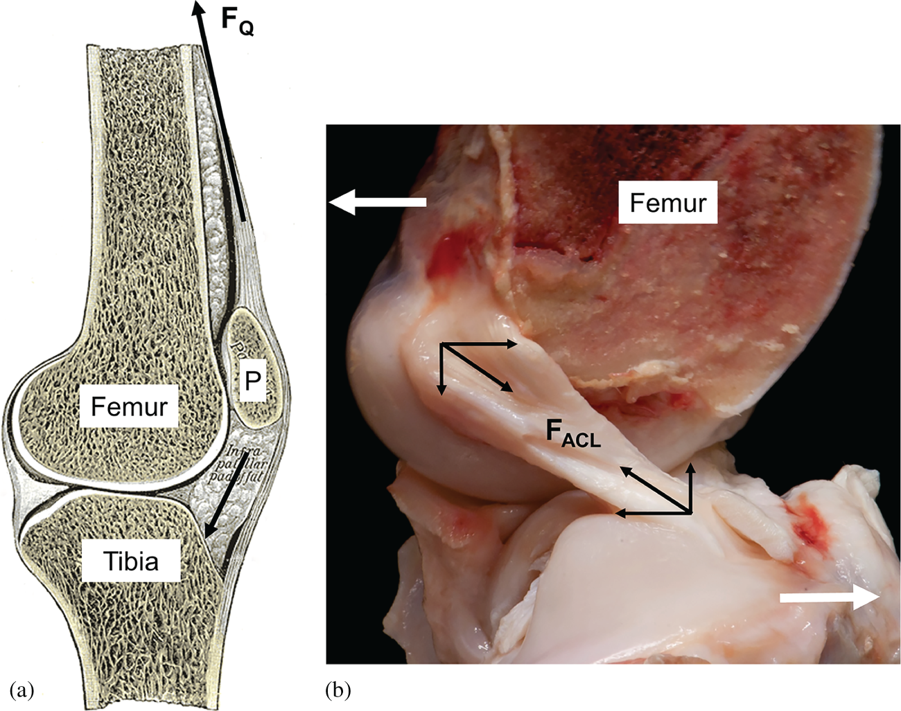 Tendon And Ligament Biomechanics Chapter 13 The Soft Hard Tissue Junction