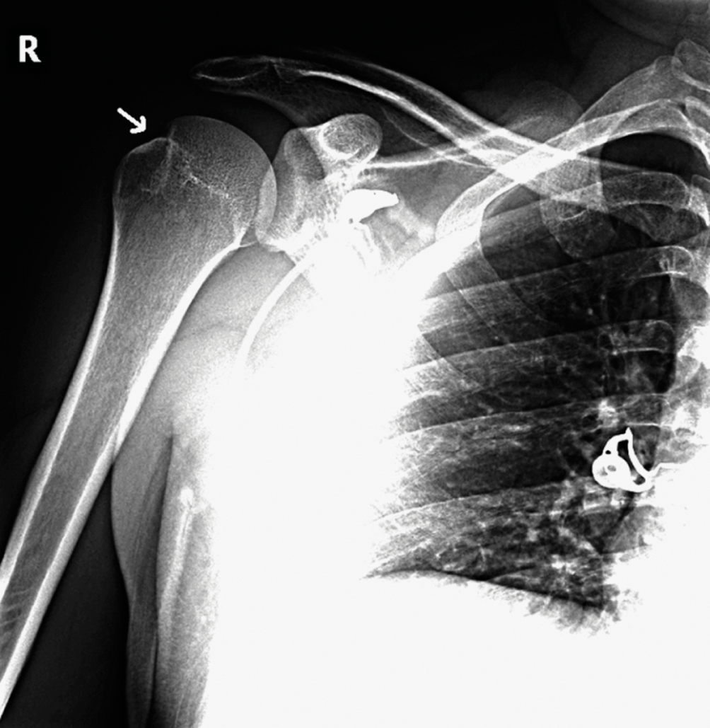 Normal Chest X-ray | PPTX, image size:1004x1029