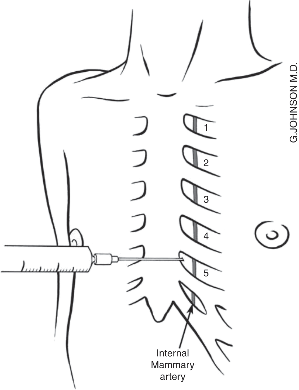 Ultrasound Guided Procedures Chapter Clinical Emergency Radiology